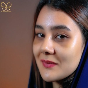 rhinoplasty-1