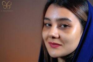 بهترین جراح بینی اردبیل - دکتر سولماز خراسانی مقدم