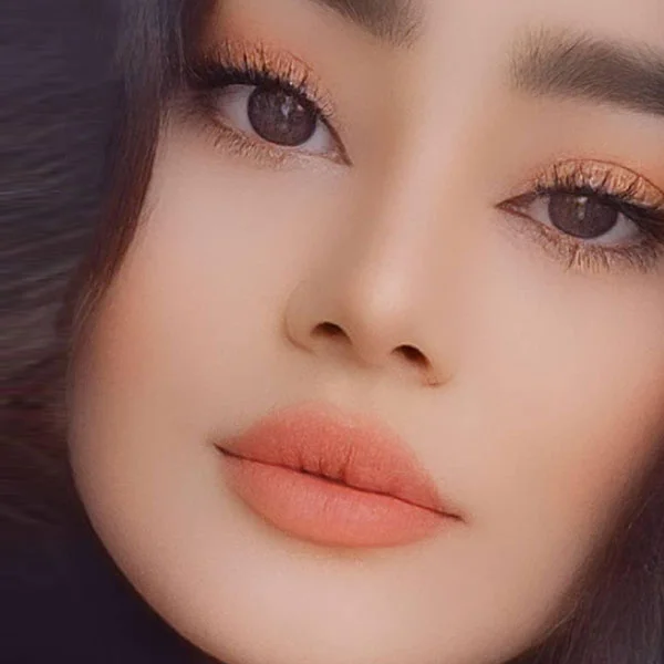 نمونه جراحی بینی دکتر خراسانی مقدم