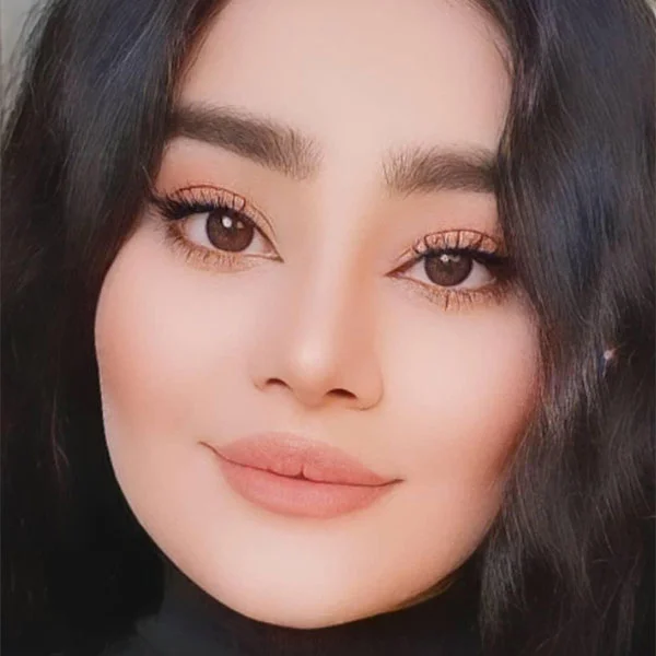 نمونه جراحی بینی دکتر خراسانی مقدم