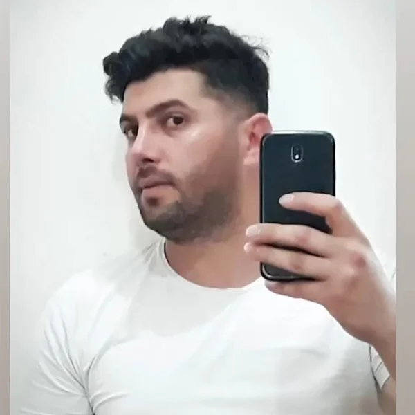 نمونه جراحی بینی دکتر خراسانی مقدم