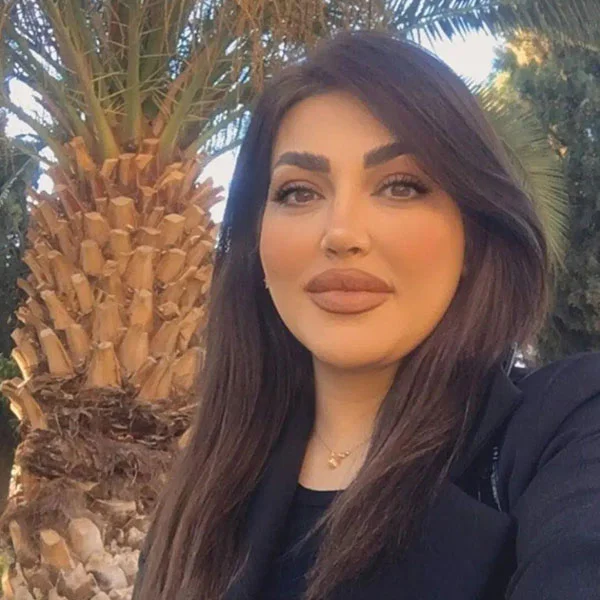 نمونه جراحی بینی دکتر خراسانی مقدم