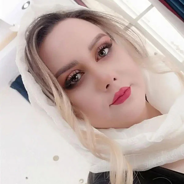 نمونه جراحی بینی دکتر خراسانی مقدم