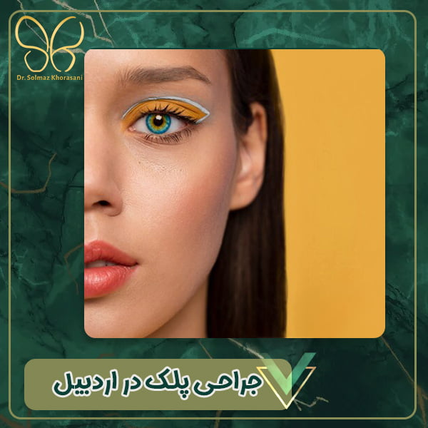 جراجی پلک در اردبیل - دکتر سولماز خراسانی مقدم