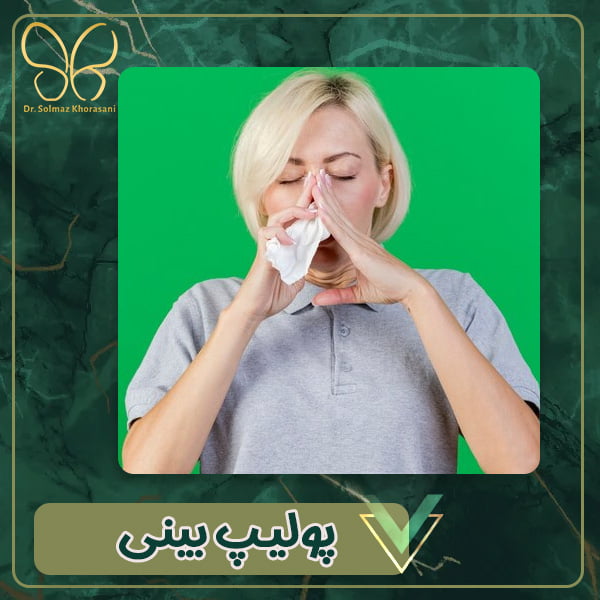 پولیپ بینی - دکتر خراسانی مقدم در اردبیل