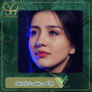 جراحی بینی در اردبیل - دکتر سولماز خراسانی مقدم