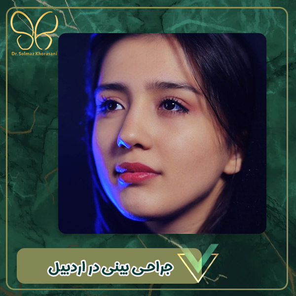 جراحی بینی در اردبیل - دکتر سولماز خراسانی مقدم