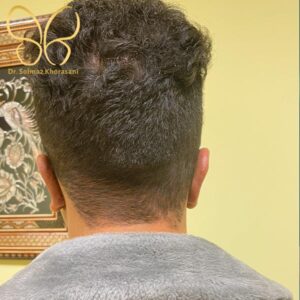 جراحی گوش در اردبیل 2 - دکتر خراسانی مقدم