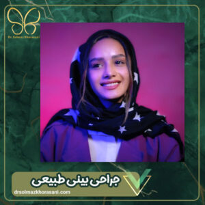 جراحی بینی طبیعی - دکتر سولماز خراسان مقدم
