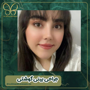 جراحی بینی گوشتی - دکتر سولماز خراسانی مقدم