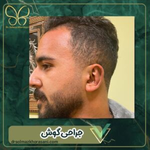 اتوپلاستی - دکتر سولماز خراسانی مقدم 
