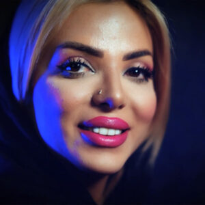 نمونه کار بهترین جراح بینی اردبیل 3