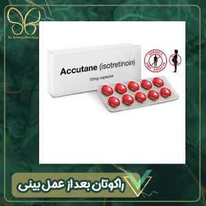 مصرف قرص آکوتان بعد از عمل بینی - دکتر سولماز خراسانی مقدم 