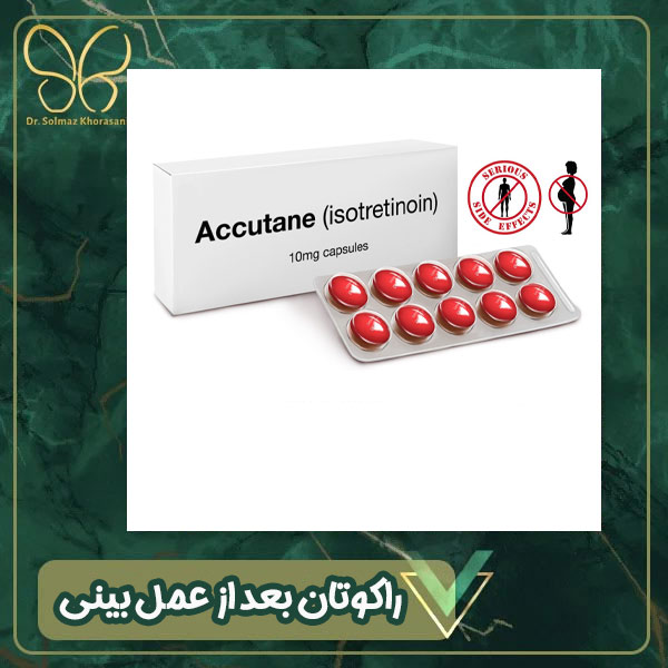 مصرف قرص آکوتان بعد از عمل بینی - دکتر سولماز خراسانی مقدم