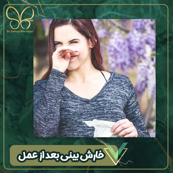 خارش بینی بعد از عمل - دکتر سولماز خراسانی مقدم