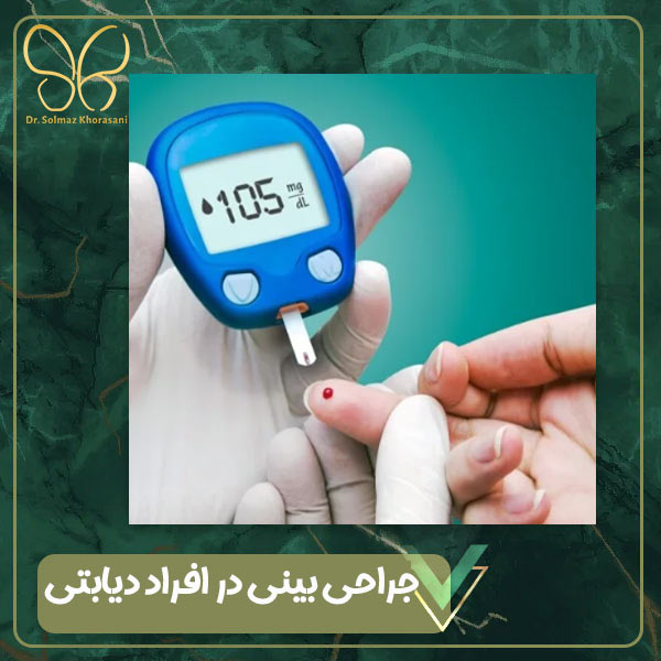 جراحی بینی در افراد دیابتی - دکتر سولماز خراسانی مقدم